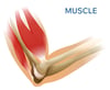 blog_hubpsot-Muscle-1